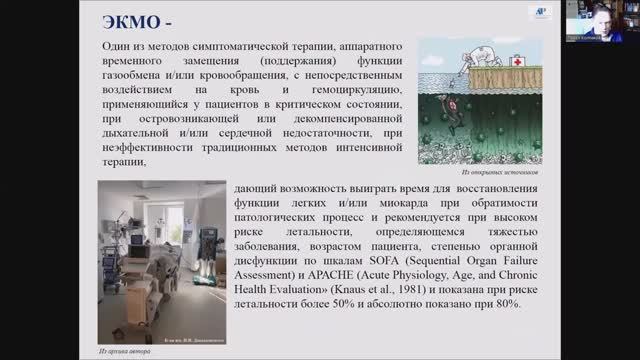 Колпаков П.Е. - ЭКМО_ общие положения, показания, противопоказания смотреть онлайн