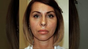 Высокие скулы, эффект минус 10 лет