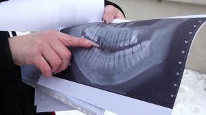 ОСТАЛАСЬ БЕЗ КЛЫКА