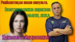 Восстановление пареза лица. Реабилитация. Кинезиотейпирование мимических мышц на стороне поражения.