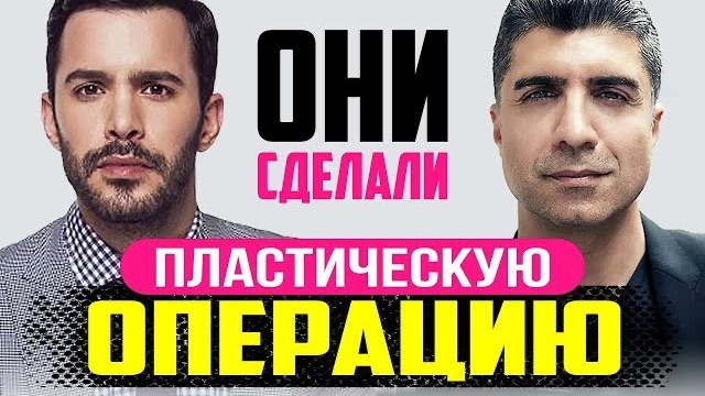 Пластические операции турецких актеров мужчин🇹🇷