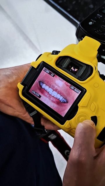 Философия идеальной улыбки: Эстетика в деталях #стоматология #лечениезубов #красиваяулыбка#медицина