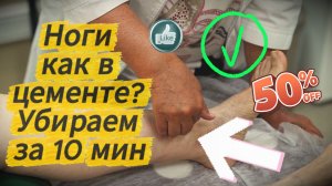 Смотрите, как убрать тяжесть в ногах прямо сейчас. Стройные ножки без варикоза в любом возрасте.