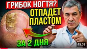 ГРИБОК НОГТЕЙ ОТПАДЕТ ПЛАСТОМ! Самое мощное домашнее средство, грибок уйдет за 2