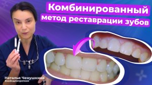 Как стоматолог преображает улыбку | Композитная реставрация