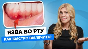Как быстро избавиться от СТОМАТИТА?  Причины и эффективное лечение язвы во рту