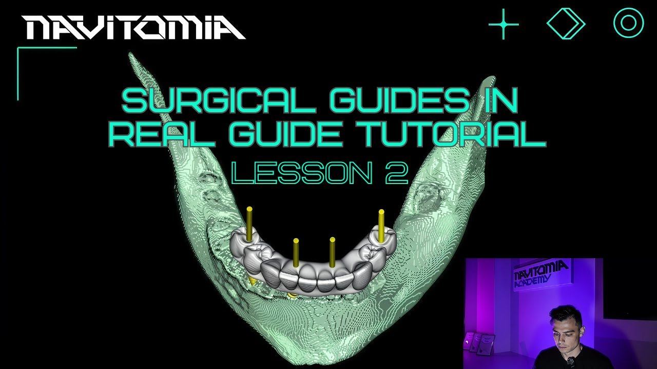 Surgical guides in RealGuide Tutorial. Lesson 2. Osteointegration, implant placement priciples смотреть онлайн