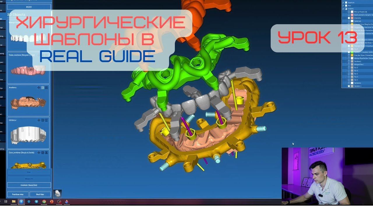 Курс в программе Real Guide. Урок 13. Разборный шаблон с одномоментной нагрузкой. Часть 3 смотреть онлайн
