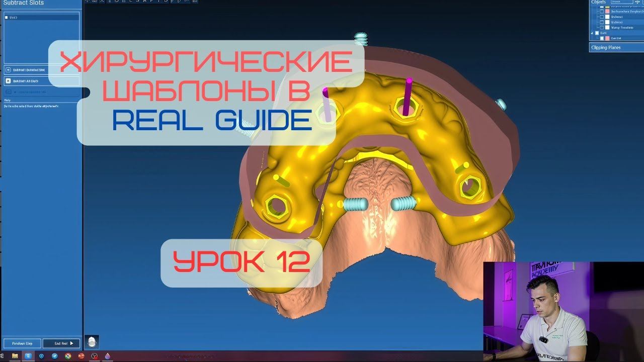 Курс в программе Real Guide. Урок 12. Разборный шаблон с одномоментной нагрузкой. Часть 2 смотреть онлайн