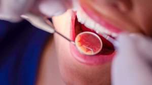 Убивает даже почки: почему надо лечить кариес и как сохранить здоровье зубов