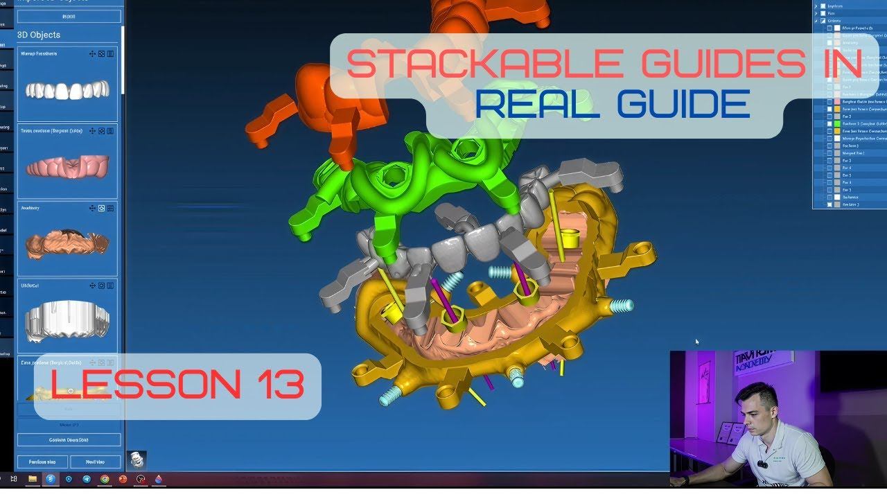 Surgical guides in RealGuide Tutorial. Lesson 13. Stackable guides, All on 4. Part 3 смотреть онлайн