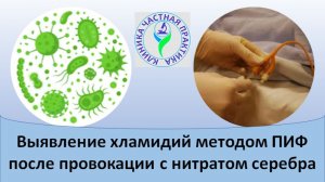 Выявление хламидий методом ПИФ после провокации