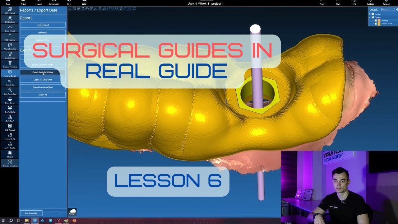 Surgical Guides In RealGuide Tutorial. Lesson 6. Sleeve Setup, Offset, Guide Creation