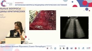 УЗИ в помощь неонатальному реаниматологу Ермоленко К.Ю. 2025