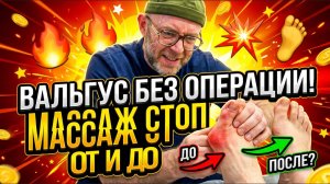 Вальгус БЕЗ операции: массаж стоп от и до, косточка уходит | Школа Ног