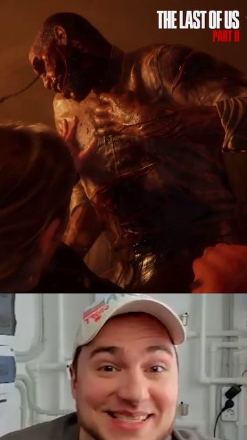 ХОЧЕШЬ ЗНАТЬ ОТКУДА ШРАМЫ