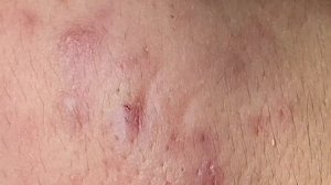 Удаление черных точек / Полная чистка лица #ТТ54