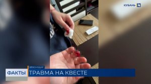 Мать рассказала о состоянии дочери, оставшейся без фаланги пальца в Краснодаре