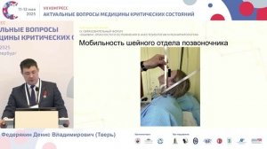 Риск трудной интубац при ожирении Федерякин Д.В.