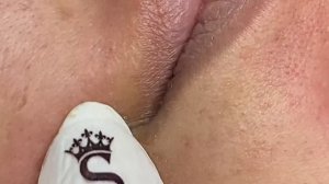 Глубокая чистка пор для посетительниц салона ТТ#40