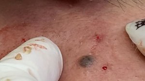 Чистка лица для девушек в дождливый день / Часть 2 ТТ#37