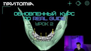 Обновленный курс в программе Real Guide. Урок 2. Принципы остеоинтеграции, торк, позиции имплантатов