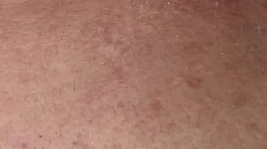 Механическая чистка лица (удаление черных точек) - #ТТ60