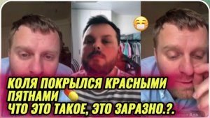 САМВЕЛ АДАМЯН, КОЛЯ ПОКРЫЛСЯ КРАСНЫМИ ПЯТНАМИ, ЭТО ЗАРАЗНО, ЧТО ЭТО ТАКОЕ .?.