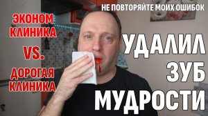 Влог: Удалил Зуб Мудрости в разных клиниках - И вот, что я понял | 40-летний холостяк