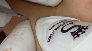 Удаляем закрытые комедоны правильно - ТТ#63_1