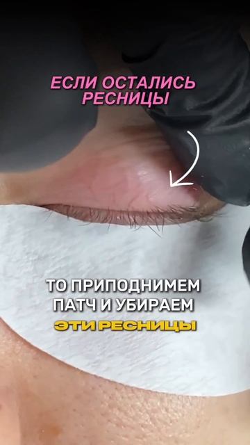 Важные правила по установке патча!