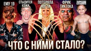 Книга рекордов Гиннесса - Что стало с невероятными людьми? Ничего хорошего?