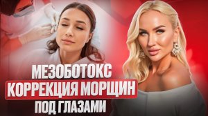 Техника мезоботокса: коррекция морщин под глазами