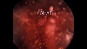 Камни. #минералы #Каменномостский_музей #сад_камней