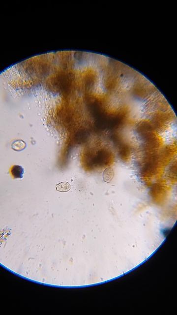 инфузории сувойки