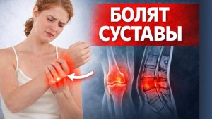 ХРУСТ В КОЛЕНЯХ — первый шаг к артрозу? Как плоские стопы разрушают ваши суставы