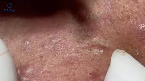 Невероятные черные точки | 45 минут удовольствия GA