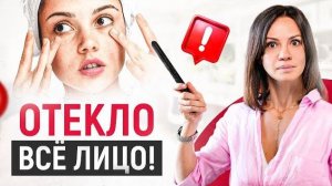 Скрытые причины отеков на лице и мешков под глазами. 90% женщин не знают об этом!