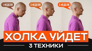 Убираем причину холки за 10 минут в день — видимый результат через неделю!