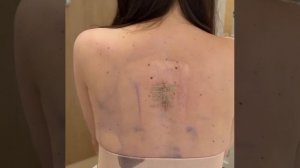 Блогер Лерчек покинула больницу, несмотря на подтвержденный рак и метастазы (2)