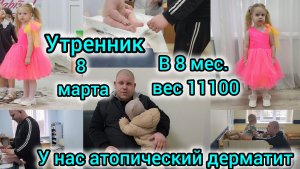УТРЕННИК 8 МАРТА🌸💐/НА ПРИЕМЕ У ПЕДИАТРА/В 8 МЕС.ВЕС 11100/У НАЗАРИКА АТОПИЧЕСКИЙ ДЕРМАТИТ