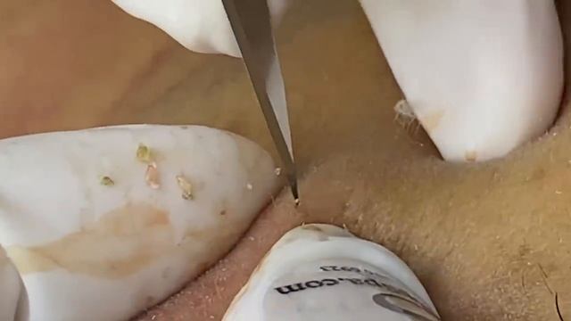 Эффективное удаление черных точек - SDS#188