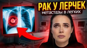 У ЛЕРЧЕК обнаружили РАК: метастазы в легких | СРОЧНАЯ ОПЕРАЦИЯ