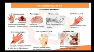 Лекция 12.1. Раны