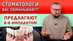 Сколько нужно имплантатов именно Вам? Почему концепция все зубы на 4-х имплантатах подходит не всем!