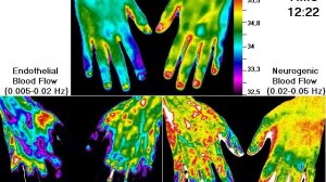 Т-Эндо-Нейро 2_Окклюз проба