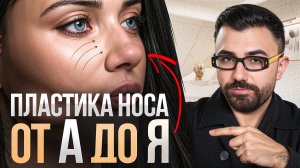 Ринопластика – всё что нужно знать перед операцией. Советы хирурга