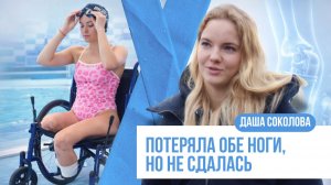 Жизнь после ампутации: история девушки, которая начала все занаво