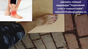 Уязвимость ахилла губит стопы, колени и тбс. Упражнения для укрепления