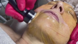 ПРОТОКОЛ ANTI-AGE ФОНОФОРЕЗ 3D: мощный антивозрастной уход для лица!